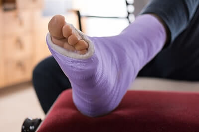 Foot Fractures treatment in the New York County, NY: Manhattan, Lenox Hill, Yorkville, Upper West Side, Upper East Side, Hell's Kitchen, Midtown East, Garment District, Diamond District, Carnegie Hill, Lincoln  Square, Murray Hill areas