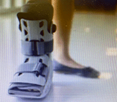 Broken Foot and Ankle Treatment in the Upper East Side, New York, NY 10065 area