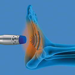 Zimmer Shockwave Therapy treatment in the New York County, NY: Manhattan, Lenox Hill, Yorkville, Upper West Side, Upper East Side, Hell's Kitchen, Midtown East, Garment District, Diamond District, Carnegie Hill, Lincoln  Square, Murray Hill areas